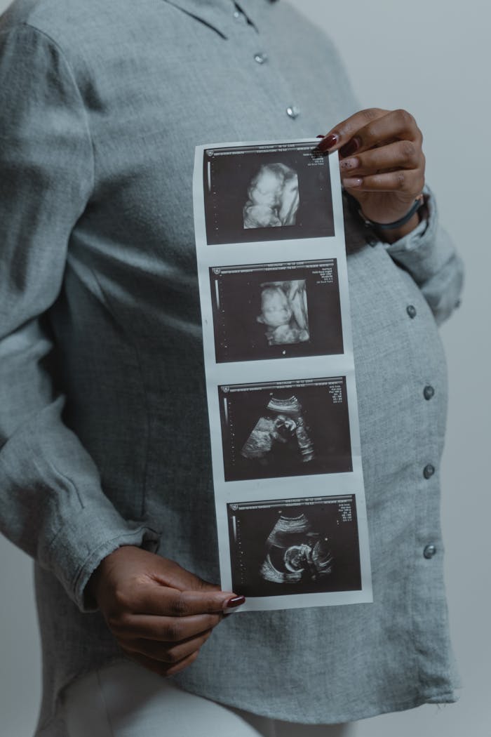 Pregnant woman holding ultrasound scans, symbolizing motherhood and new life.